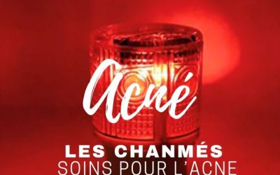 Soigner l&rsquo;acné au naturel avec un savon solide dermatologique