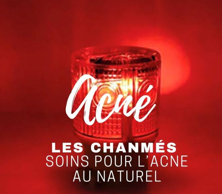 Soigner l&rsquo;acné au naturel avec un savon solide dermatologique